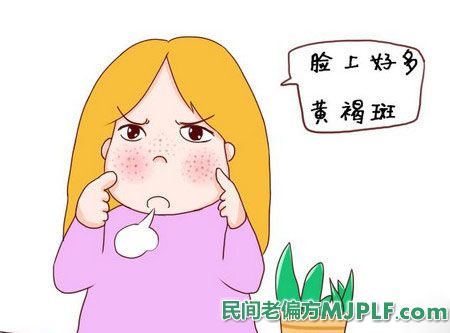 四个中药偏方治疗黄褐斑有奇效