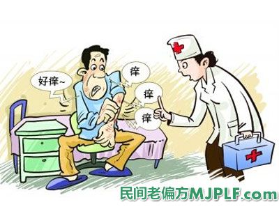 五个中药偏方治疗银屑病