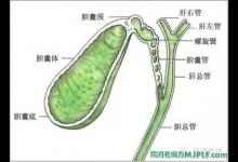 治疗慢性胆囊炎民间偏方大全