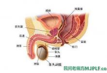 治疗前列腺炎民间小偏方大全